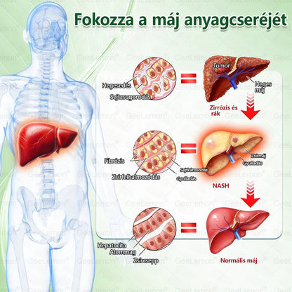 💕💕💕GeeLemon® Glumasetide 8az 1-ben Karcsú és EgészségesNano Mikrotűs Tapasz (Napi 1alkalom – látható változásakár 7 nap alatt) ✅ Elhízásra,bőrfeszesítésre,cukorbetegségre, alvásiapnoéra, ízületekre stb