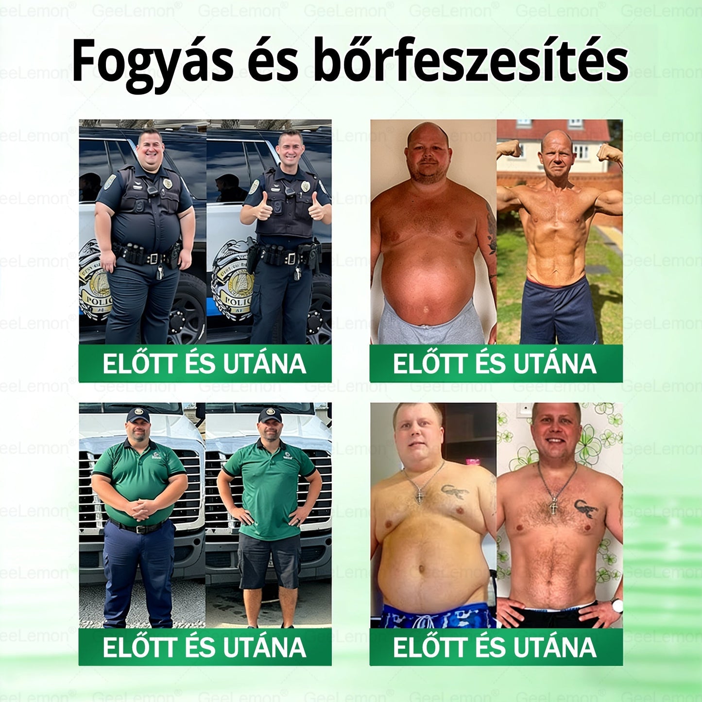 💕💕💕GeeLemon® Glumasetide 8az 1-ben Karcsú és EgészségesNano Mikrotűs Tapasz (Napi 1alkalom – látható változásakár 7 nap alatt) ✅ Elhízásra,bőrfeszesítésre,cukorbetegségre, alvásiapnoéra, ízületekre stb