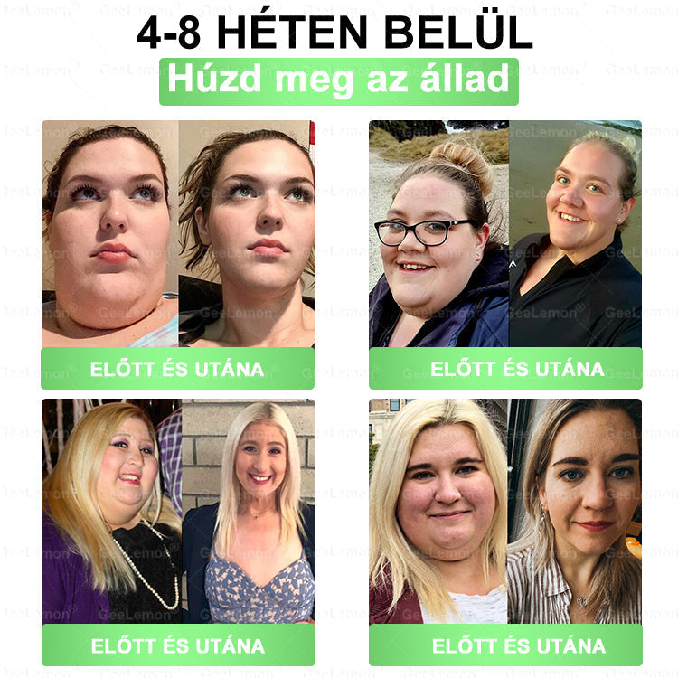 💕💕💕GeeLemon® Glumasetide 8az 1-ben Karcsú és EgészségesNano Mikrotűs Tapasz (Napi 1alkalom – látható változásakár 7 nap alatt) ✅ Elhízásra,bőrfeszesítésre,cukorbetegségre, alvásiapnoéra, ízületekre stb