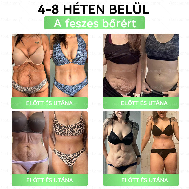💕💕💕GeeLemon® Glumasetide 8az 1-ben Karcsú és EgészségesNano Mikrotűs Tapasz (Napi 1alkalom – látható változásakár 7 nap alatt) ✅ Elhízásra,bőrfeszesítésre,cukorbetegségre, alvásiapnoéra, ízületekre stb